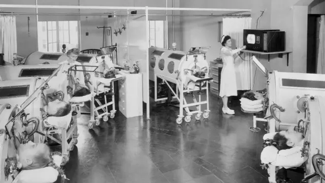 تسبب مرض شلل الأطفال في مضاعفات دائمة