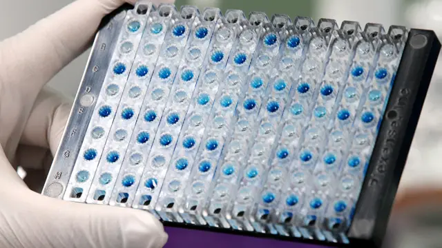 대규모 항체 검사를 통해 '숨은 감염자'가 얼마나 되는지 가늠해볼 수 있다