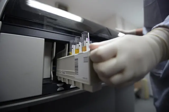 วันเอดส์โลก, โรคเอดส์, เอชไอวี, ยาต้านไวรัส, ผู้ติดเชื้อ