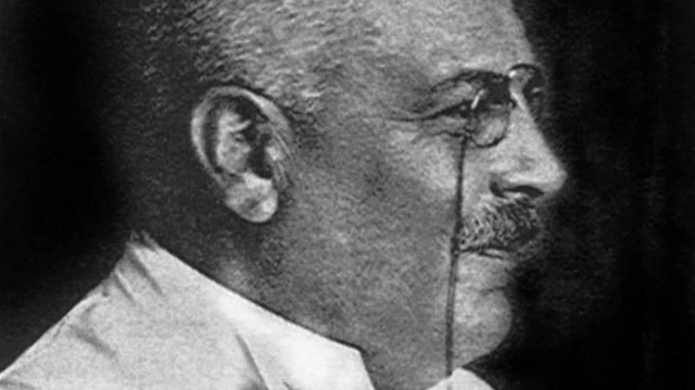 ڈاکٹر الزائیمر