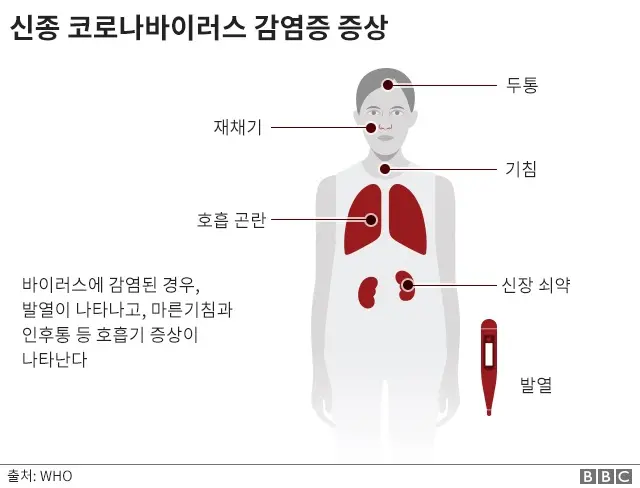 신종 코로나바이러스 증상