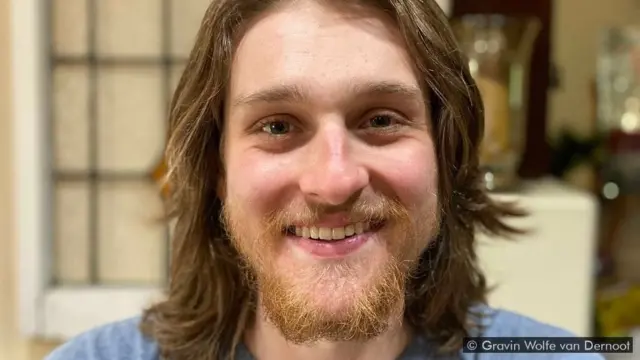 미국 콜로라도주에 거주하는 그레이빈 울프 반 데르누트는 "사람들이 팬데믹이 끝난 것처럼 행동하고 있다"고 말했다