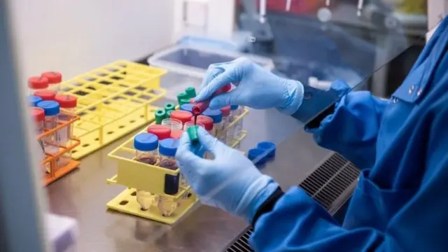 টিকা তৈরিতে অক্সফোর্ডের গবেষণা।