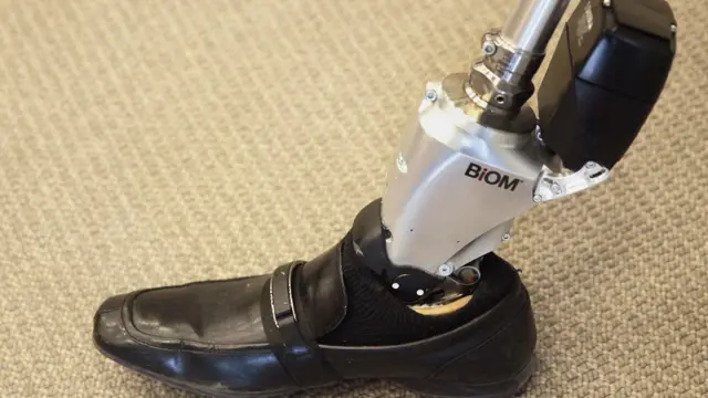 Prótesis inteligente BiOM