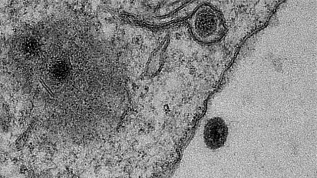 ยังไม่เป็นที่แน่ชัดว่า "ไวรัสยารา" สามารถก่อโรคในมนุษย์ได้หรือไม่