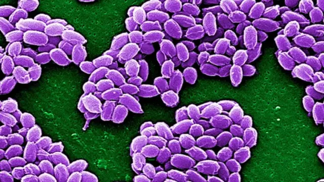 சைபீரியாவில் உறைபனி உருகும்போது ஆந்த்ராக்ஸ் கிருமி வெளியானது