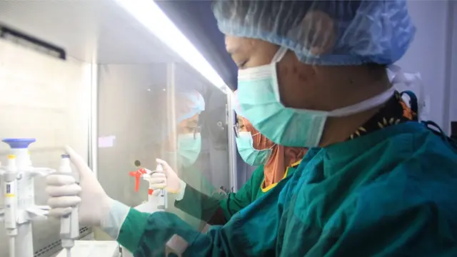 covid19, autoimun, lupus, obat, dexamethasone, virus corona