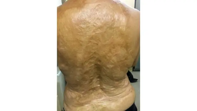 La espalda de Sylvia.