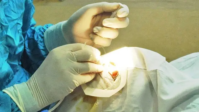 المستشفى يقول إن القرنية ليست عضوا من أعضاء الجسم (أرشيف)