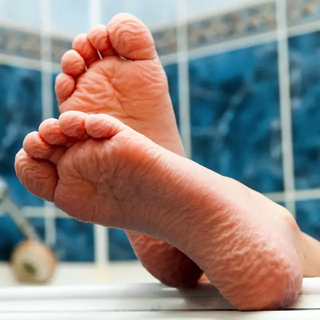 Koža na našim stopalima i dlanovima se smežurava i nabire u kupki, dok drugi delovi tela ne prolaze kroz istu transformaciju