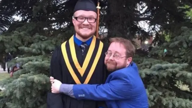 آلان موت يبلغ طوله 157 سم، وهو أطول من فئة الأقزام بحوالي 10 سم