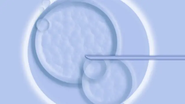 IVF