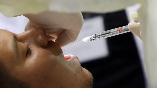 تسوس الأسنان