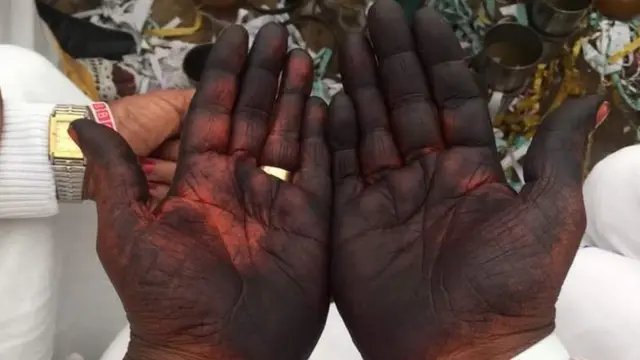 Dubartii harkishee hiinnaadhaan miidhage