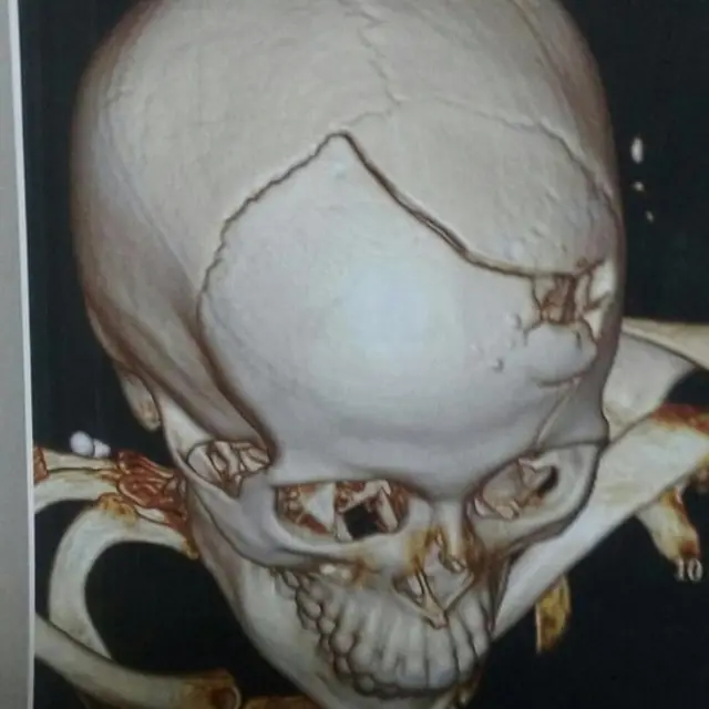 Ressonância magnética do crânioAnna Paula Cotta