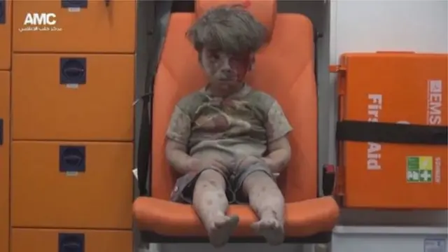 تصدرت صورة الطفل السوري عمران الذي أُنقذ من تحت الأنقاض في المنطقة الشرقية من حلب وسائل الإعلام في العالم