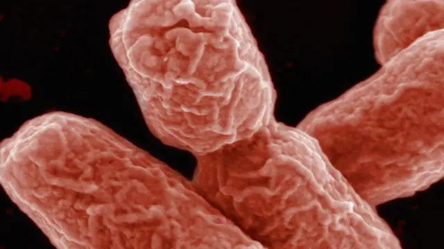 बैक्टीरिया