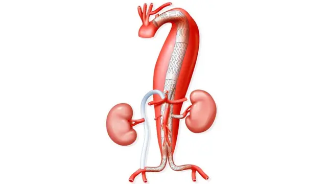 सांकेतिक तस्वीर