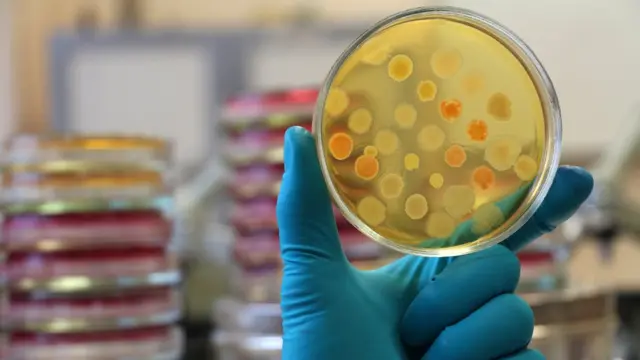 Una mano con guante azul sostiene una muestra de células.