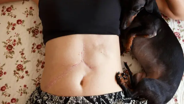 سپائنی ماؤس