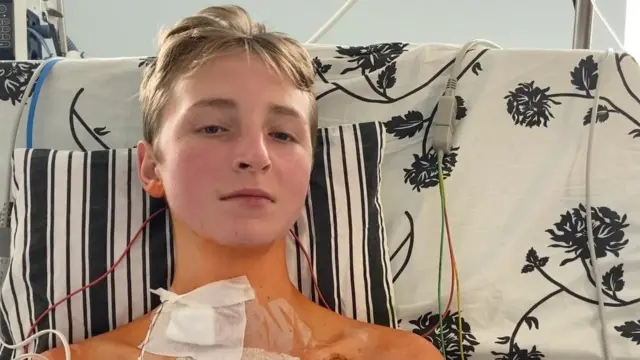 трансплантація