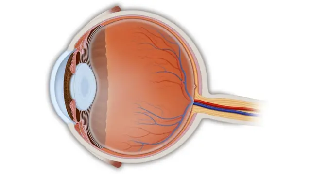 ภาพจำลองส่วนประกอบของลูกตา โดยจอประสาทตาคือเนื้อเยื่อที่อยู่ด้านหลังและมีเส้นเลือดมาเลี้ยงจำนวนมาก