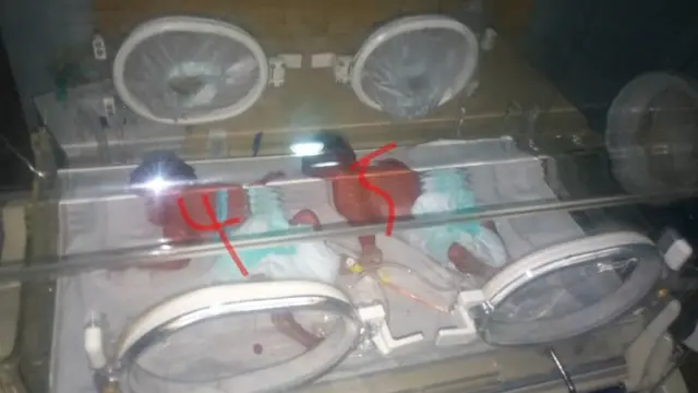 Two of di pikins dem