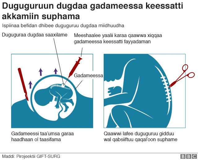 Adeemsa yaaliichi itti gaggefame
