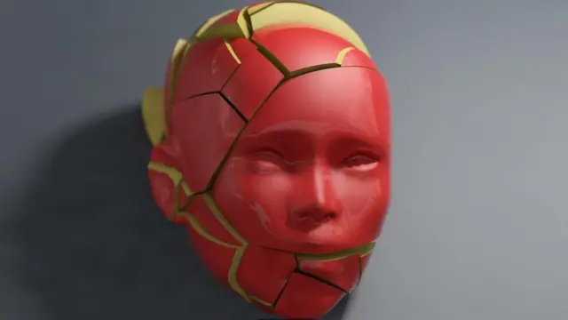 المصابون بداء الشقيقة أكثر عرضة للإصابة بالاكتئاب والقلق والتفكير في الانتحار