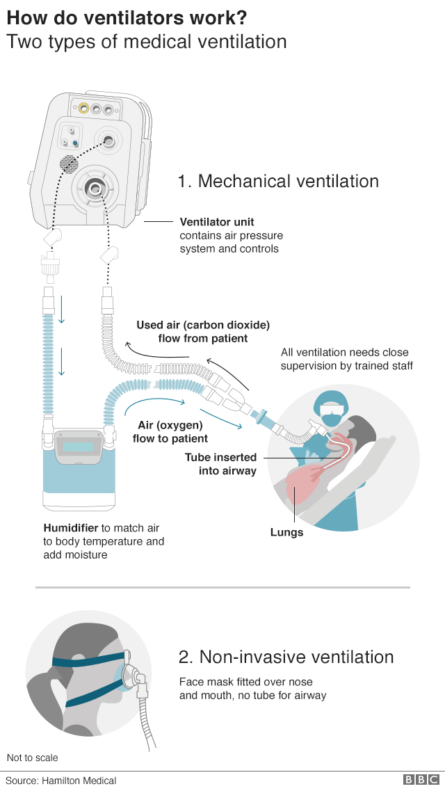 How does mechanical ventilation work during an operation?