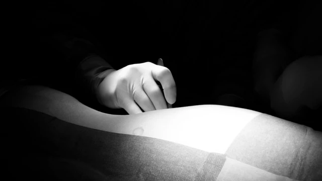 Mano de un cirujano con un bisturí