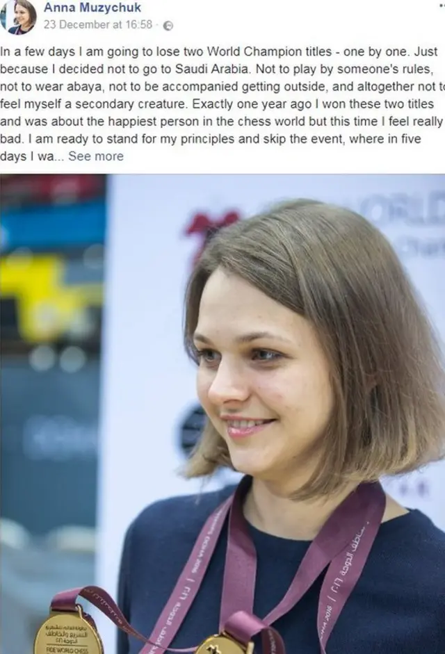 آنا موزیچوک