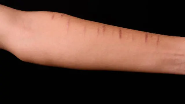 आत्महत्या