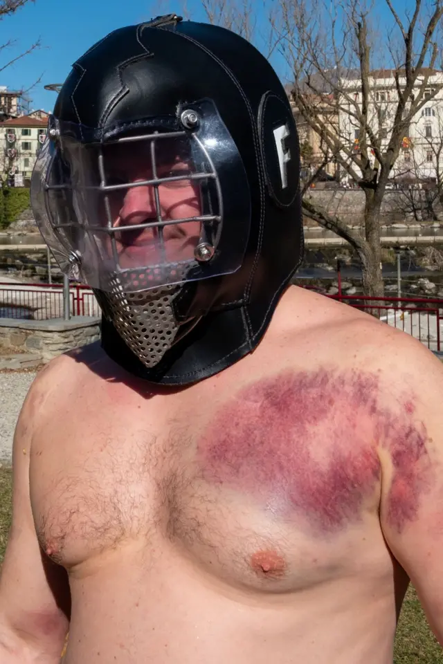 হেলমেট পরে মাথায় আঘাত ঠেকালেও এমন আঘাত এই উৎসবে বেশ ঘটে।