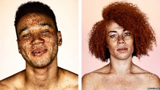 ફ્રેકલ્સ ધરાવતા લોકોની તસવીરો