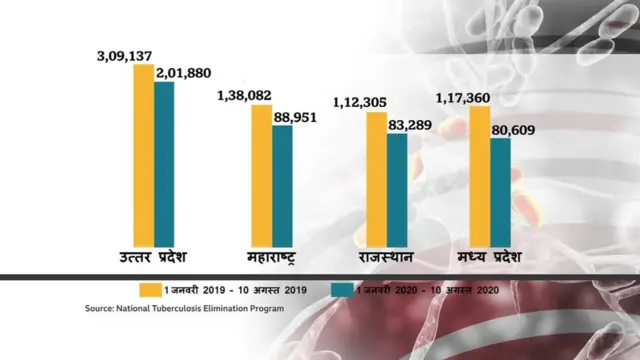 कोरोना से बढ़ा 'साइलेंट किलर' टीबी का ख़तरा