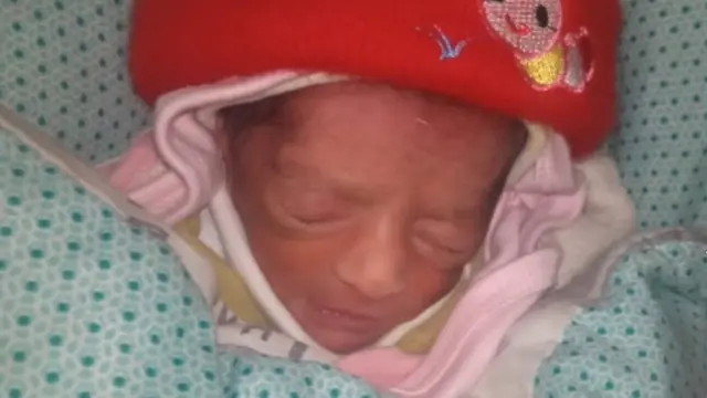 Bayi perempuan