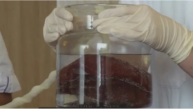 నెలలు నిండకుండా జన్మించిన శిశువును కృత్రిమ గర్భసంచిలో 4 వారాల పాట ఉంచిన తరువాత బయటకు తీయాలి.