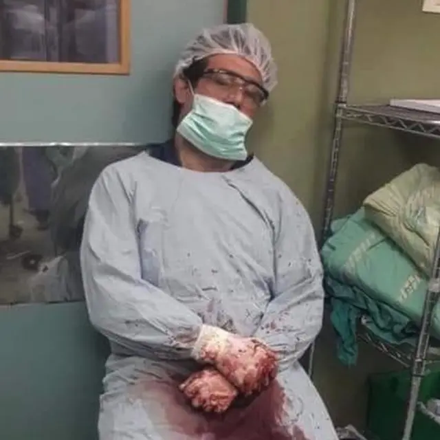 Dr Adnan Al Bursh wearing a blood-stained theatre gown