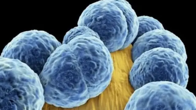 एंटी बैक्टिरिया