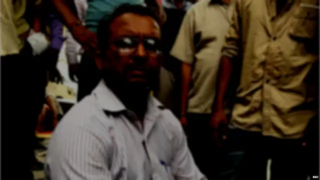 सफ़दरजंग का बर्न वॉर्ड