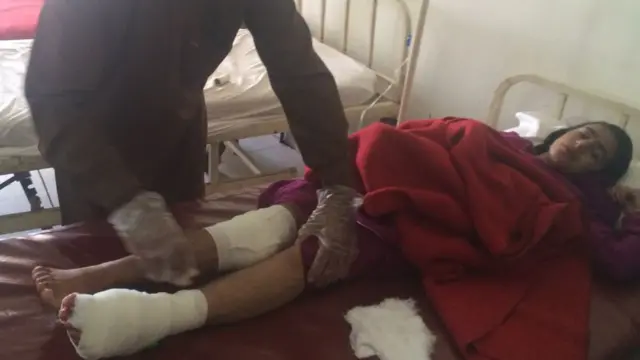 کشمیر، فائرنگ