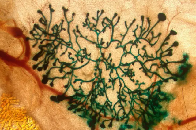 સાંકેતિક તસવીર