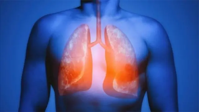 फुप्फुसं