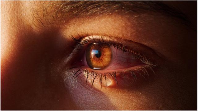 Qué dicen los ojos sobre nuestra salud?