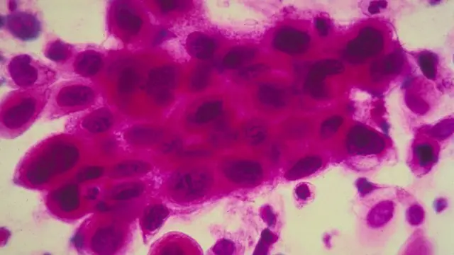 પ્રતીકાત્મક તસવીર