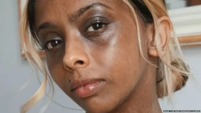 'ਮੈਂ ਰੰਗ ਗੋਰੀ ਕਰਨ ਵਾਲੀ ਕਰੀਮ ਕਿਉਂ ਵਰਤੀ'