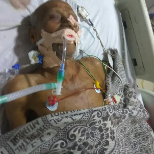 धर्मा पाटील यांच्यावर मुंबईतल्या जे जे रुग्णालयात उपचार सुरू आहेत.