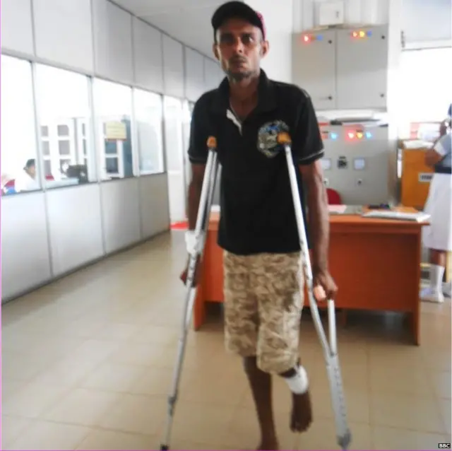 වලස් ප්රහාරයකින් තුවාල ලැබූ තරුණයෙක්