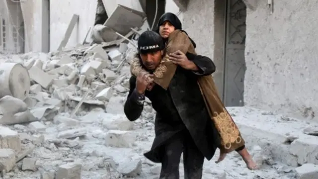 Cənab Kibry-nin sözlərinə görə Hələbə Rusiya və Suriya qüvvələrindən başqa zərbə endirəcək tərəf yoxdur